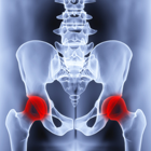 Radiographie d'une hanche avec articulation coxo femorale en rouge